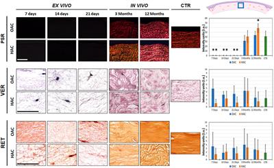 Development of stromal differentiation patterns in heterotypical models of artificial corneas generated by tissue engineering